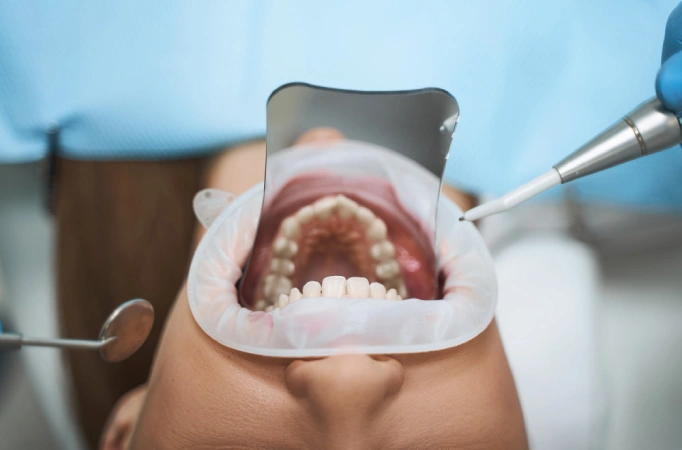 Dentist explaining bite treatment options for better oral health and alignment